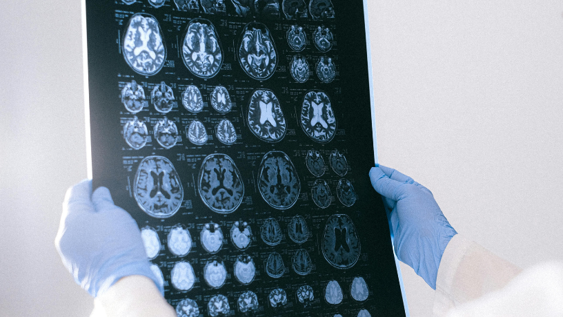 Para o Dr. Gustavo Khattar de Godoy, a segunda opinião em radiologia ajuda médicos e pacientes a tomarem decisões com mais confiança.